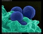 Staphylococcus aureus MRSA